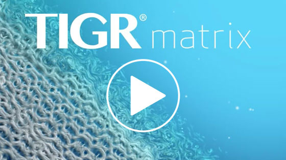 TIGR® Matrix | Video UpViser Spain